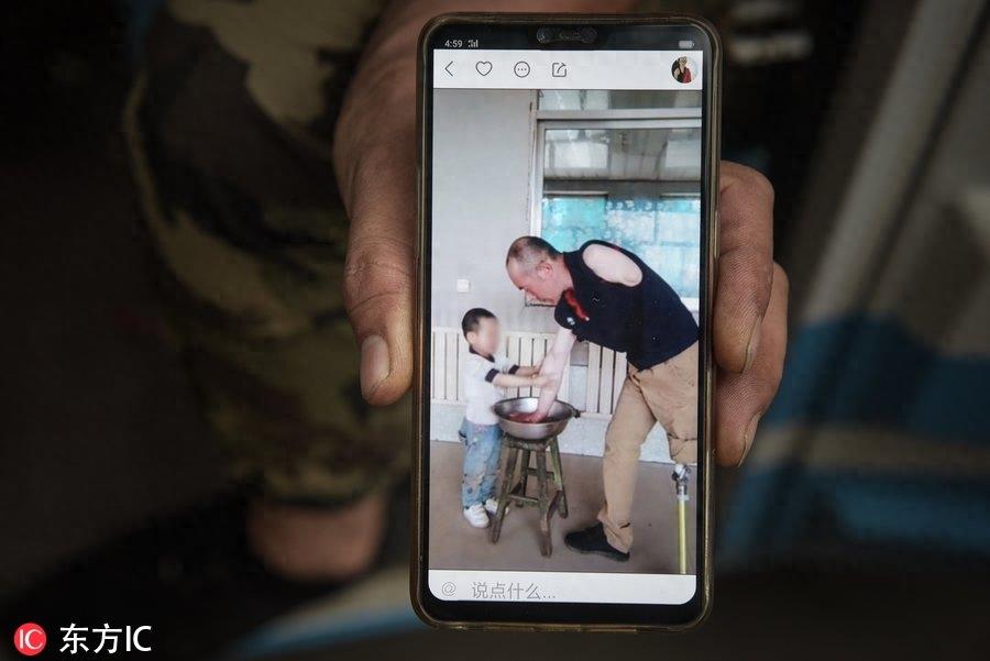 手脚截肢遭妻子抛弃，网红“铁腿哥”骑行卖唱供儿上学！