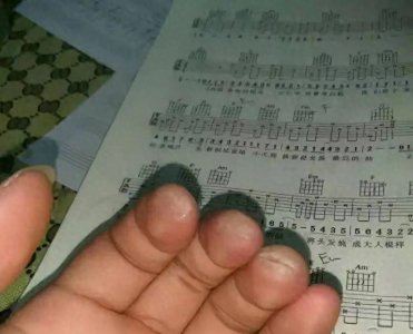 ​弹吉他一定要有手茧吗？