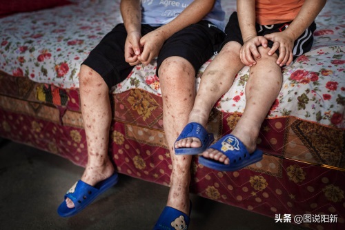 山村“魔咒”：兄弟俩出生3月后同患怪病，夫妻悔不该走到一起