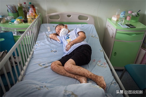 山村“魔咒”：兄弟俩出生3月后同患怪病，夫妻悔不该走到一起