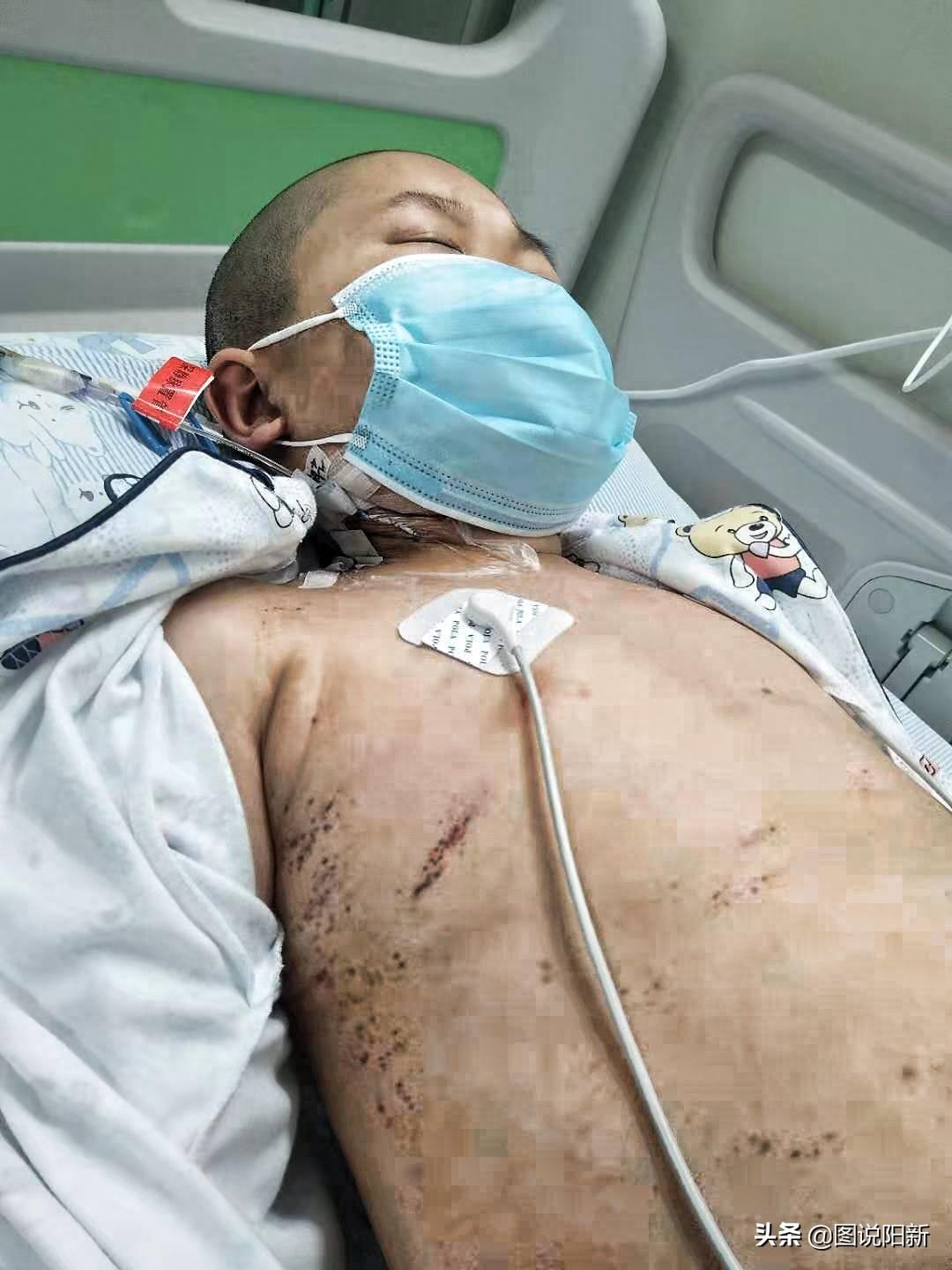 山村“魔咒”：兄弟俩出生3月后同患怪病，夫妻悔不该走到一起