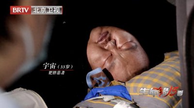 ​718.8斤刷新中国肥胖体重纪录，成为“中国第一胖”！33岁蒙古族小伙56天狂减