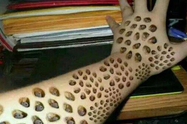 玉米男孩的故事 感觉后背痒把虫子抠出来