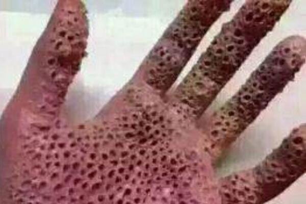 玉米男孩的故事 感觉后背痒把虫子抠出来