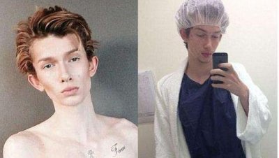 ​小伙花43万整容成美女 结果发现自己还是喜欢女性