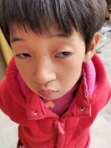 ​农村二级残疾补助标准是多少（农村二级残疾证一年补贴）