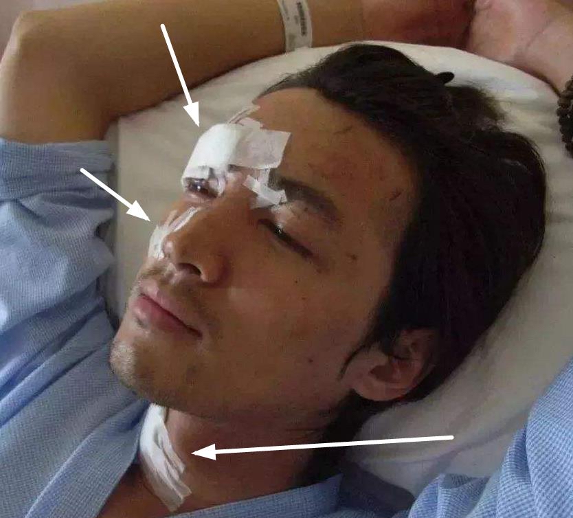 胡歌毁容前照片高清帅气图片 胡歌毁容事件始末