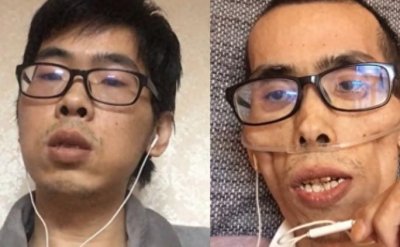 ​抗癌466天终离世，网红小伙告诉我们：别走太快，等等自己的身体