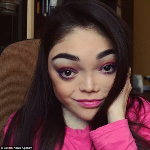 ​女子患怪病变丑总被嘲笑 网上教美妆成网红还拿奖