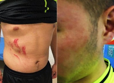 ​追打+飞踹！曝成都业余联赛裁判遭围殴 全身多处受伤+脑震荡