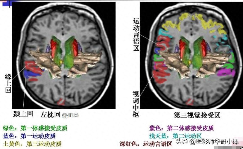 脑部磁共振（MRI）功能图谱--精品图集