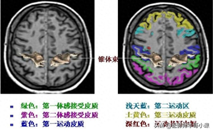 脑部磁共振（MRI）功能图谱--精品图集