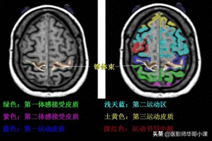 脑部磁共振（MRI）功能图谱--精品图集