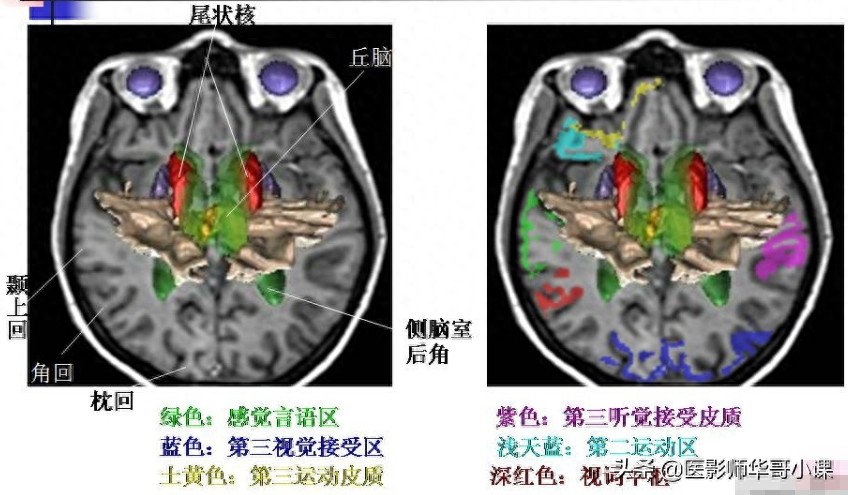 脑部磁共振（MRI）功能图谱--精品图集
