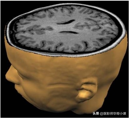 脑部磁共振（MRI）功能图谱--精品图集