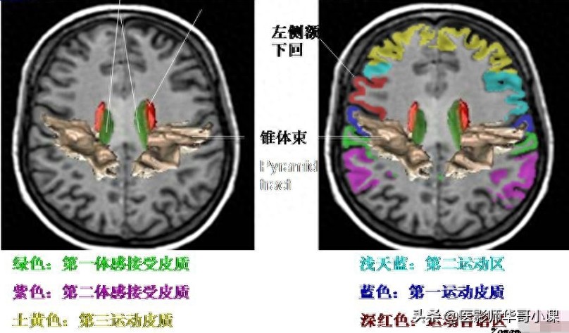 脑部磁共振（MRI）功能图谱--精品图集