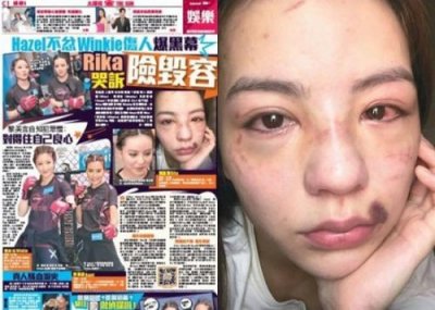 ​真人秀玩出火，香港女星被暴打毁容，导致恐有永久性伤害！