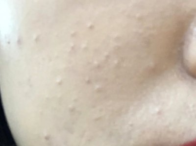 ​误区！很多人误以为它是闭口，来看看你是不是也认错了